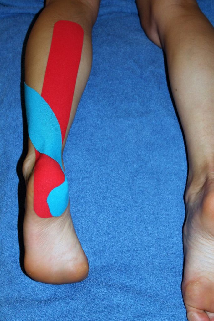 Kinesiology Taping para el Tendón de Aquiles UKRunChat Wzrost