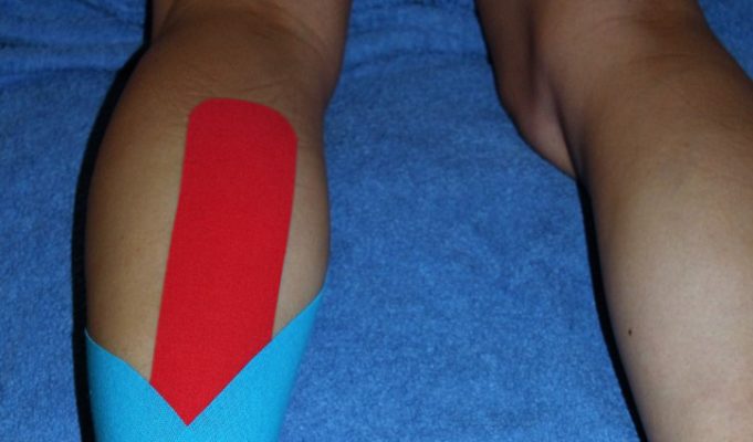 Achilles taping for runners